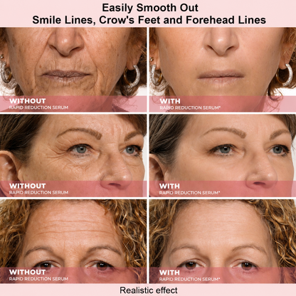 Results in 60 Seconds - MYGlowmira Rapid Wrinkle-Reducing Serum for Wrinkles, Bags & Dark Circles