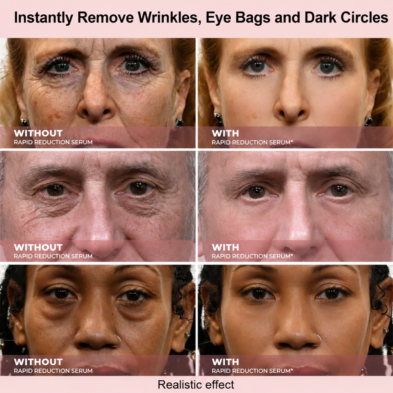 Results in 60 Seconds - MYGlowmira Rapid Wrinkle-Reducing Serum for Wrinkles, Bags & Dark Circles