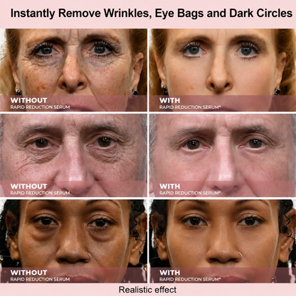 Results in 60 Seconds - MYGlowmira Rapid Wrinkle-Reducing Serum for Wrinkles, Bags & Dark Circles