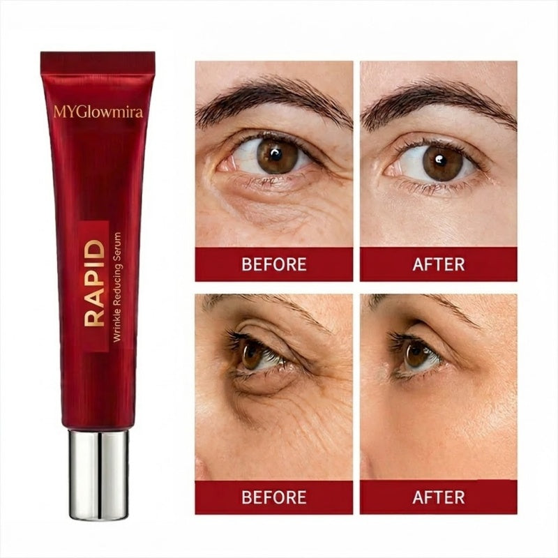 Results in 60 Seconds - MYGlowmira Rapid Wrinkle-Reducing Serum for Wrinkles, Bags & Dark Circles