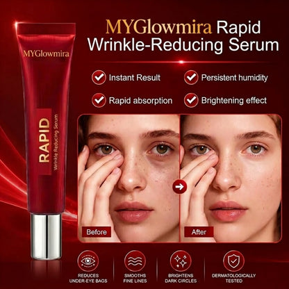 Results in 60 Seconds - MYGlowmira Rapid Wrinkle-Reducing Serum for Wrinkles, Bags & Dark Circles